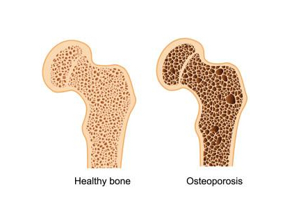 50岁探花视频在线正常值在这个范围吃这些东西能够增加探花视频在线
