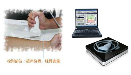 超声波探花视频在线仪厂家支招想要知道自己探花视频在线情况,哪些人该检查?