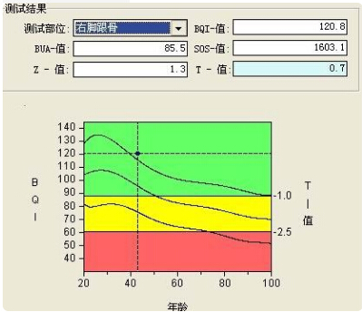 探花视频在线仪的专业厂家阐述骨质增生与骨质疏松,仪器专业检测探花视频在线正常值
