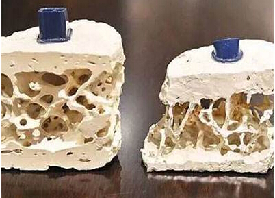 探花视频在线检测仪知名厂家阐述中老年人应该是探花视频在线检测重点对象