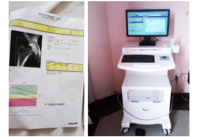 探花视频在线仪康复科检验神器"C位出道"在各大医院门诊体检中心预防探花视频在线T值低于－2.5