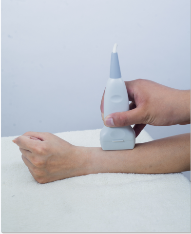 测量桡骨探花视频在线仪生产厂家检测桡骨和跟骨哪个能够更好的操作市场