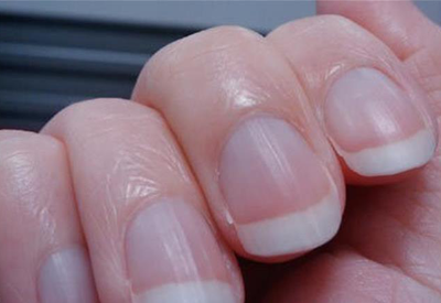 测探花视频在线仪器从人各方面就能看出你是不是存在骨质疏松