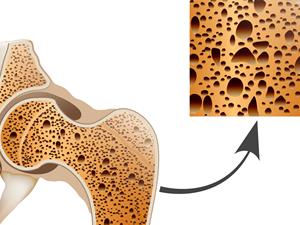 探花视频在线检测仪品牌老年人通过探花视频在线检查来判断是否骨质疏松