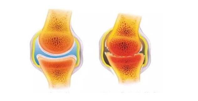儿童探花视频在线检测仪品牌你知道骨格线是什么？骨骼线闭合有哪些表现？